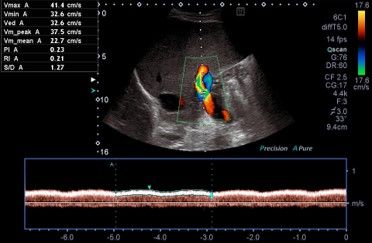 Gemeinschaftspraxis für Innere Medizin und Gastroenterologie - Wunstorf - Ultraschalluntersuchungen Duplexsonografie Pfortader Rechts