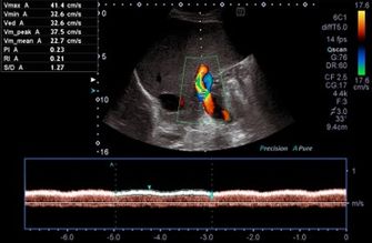 Gemeinschaftspraxis für Innere Medizin und Gastroenterologie - Wunstorf - Ultraschalluntersuchungen Duplexsonografie Pfortader Rechts