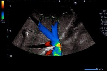 Gemeinschaftspraxis für Innere Medizin und Gastroenterologie - Ultraschalluntersuchungen Lebervenenstern