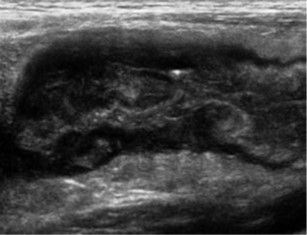 Gemeinschaftspraxis für Innere Medizin und Gastroenterologie - Ultraschalluntersuchungen Morbus Cron
